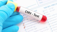 Cytomegalovirus (CMV)