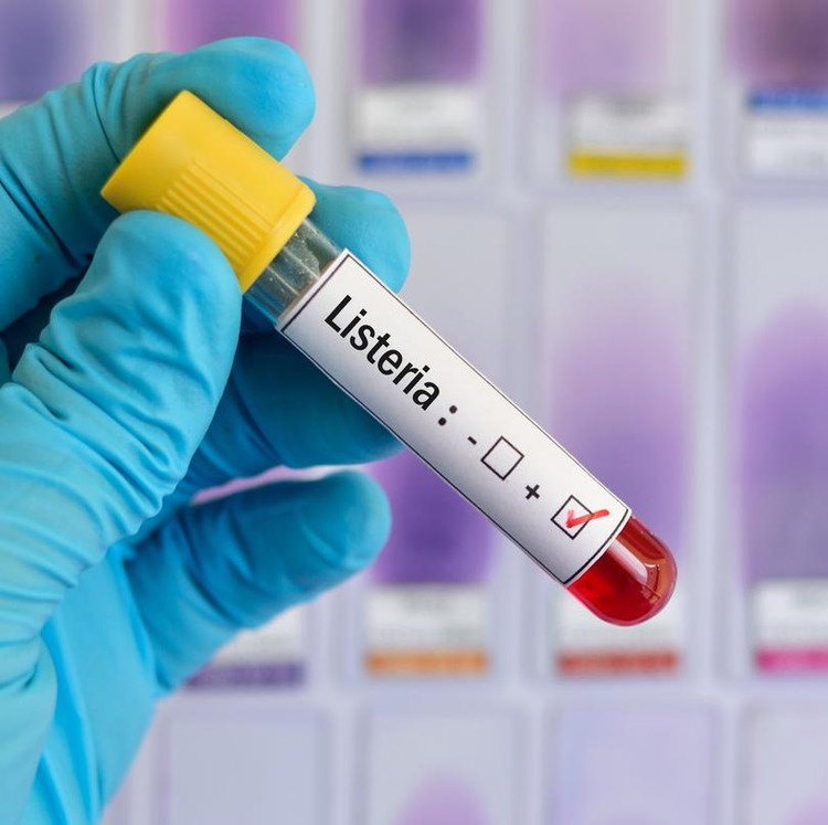 Ilustrasi Listeriosis atau Listeria
