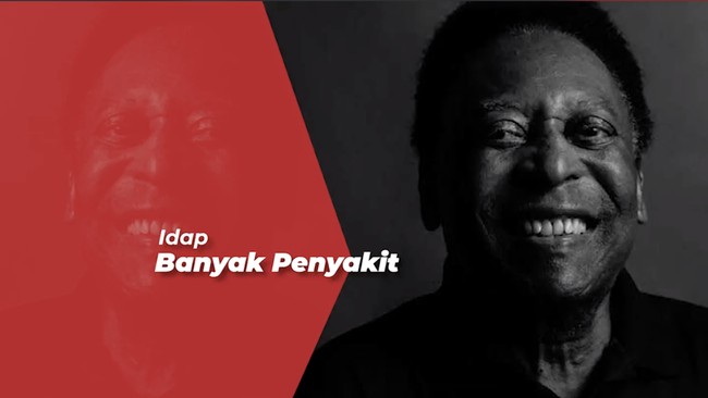 Pele Legenda Sepakbola Asal Brasil, Meninggal Dunia di Usia 82 Tahun
