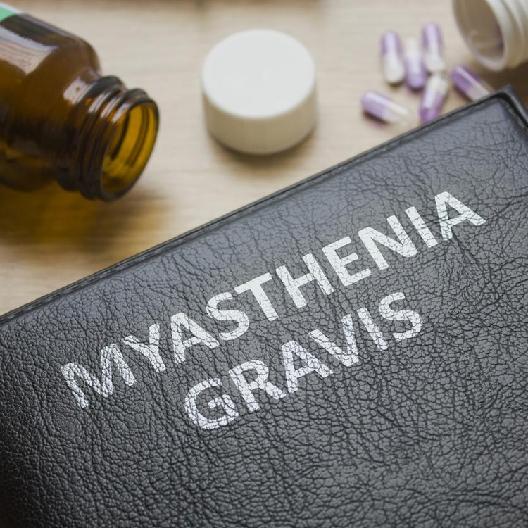 Ilustrasi myasthenia gravis Ilustrasi myasthenia gravis
