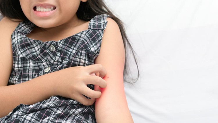girl scratch the itch with hand , Concept with Healthcare And Medicine.