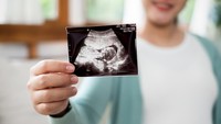 Terpopuler: 7 Tanda Janin Kekurangan Oksigen - Kisah Pria Sulsel Nikahi Wanita Asal China