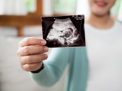 Terpopuler: 7 Tanda Janin Kekurangan Oksigen - Kisah Pria Sulsel Nikahi Wanita Asal China