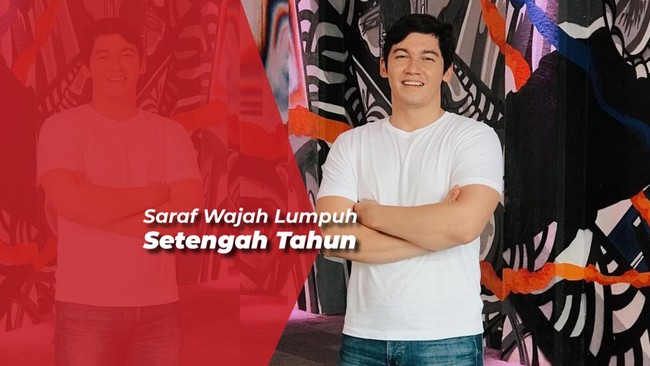 Alami Sakit Mirip Justin Bieber, Samuel Zylgwyn Trauma AC