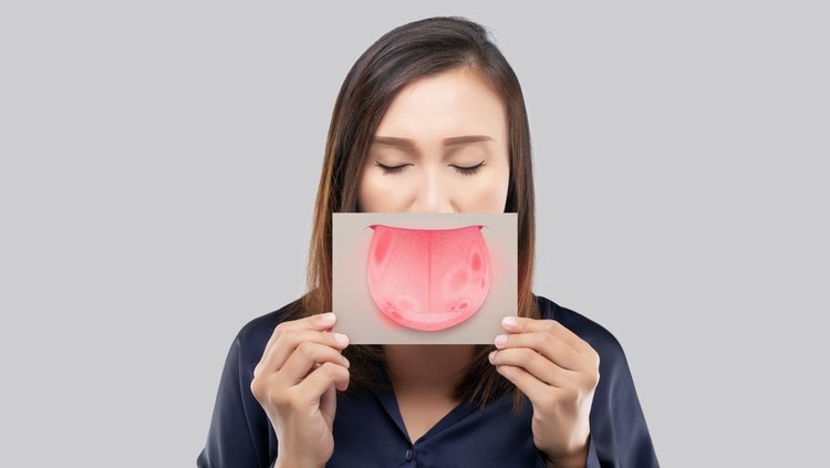 The woman show the picture of tongue problems, Illustration benign migratory glossitis on a brown paper, Behcet's Disease