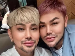 6 Potret Ivan Gunawan & Caren Delano Usai Oplas Disebut 'Twins' bak Kakak-Adik