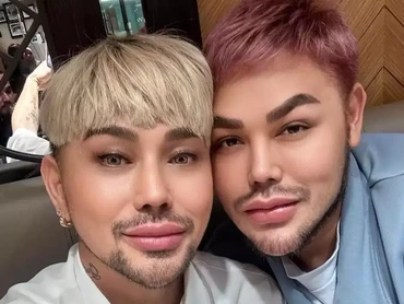 6 Potret Ivan Gunawan & Caren Delano Usai Oplas Disebut 'Twins' bak Kakak-Adik