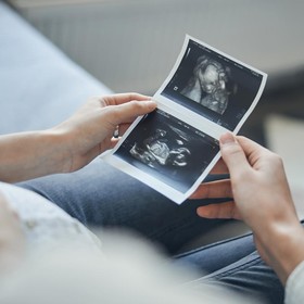 Mengenal Klinik Morula IVF, Solusi Terbaik untuk Kamu yang Ingin Segera Dapatkan Momongan