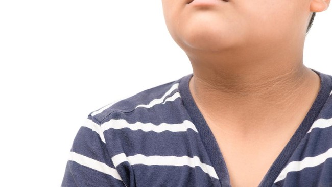 Per Januari 2023: 1.645 Anak Indonesia Kena Diabetes Diabetes bukan hanya dialami orang dewasa. Anak-anak juga banyak yang terkena diabetes, terutama di Indonesia.