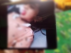 Kronologi Bocah Sukabumi Alami Bibir Sobek gegara Lato-lato