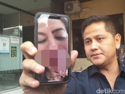 Adik Perlihatkan Video Usai Venna Melinda Diduga Di-KDRT