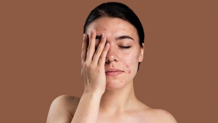 img-title 6 Tanda Ini Menjadi Peringatan Kamu Tidak Cocok dengan Suatu Produk Kecantikan, Cek Ada yang Pernah Dirasakan?