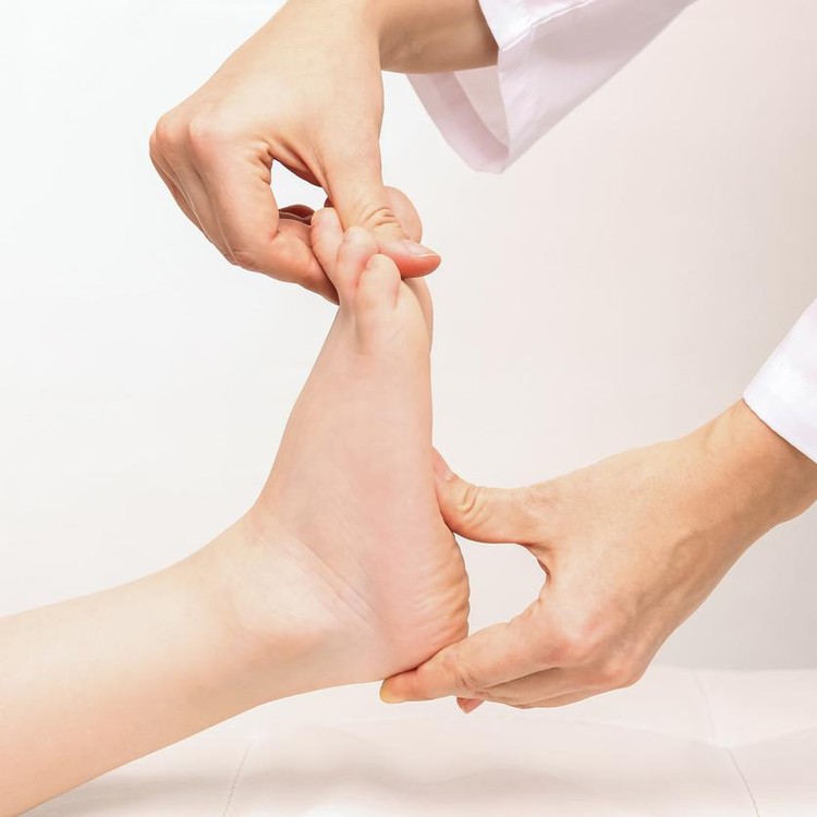 Ilustrasi flat foot atau kaki rata Ilustrasi flat foot atau kaki rata