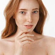 7 Kebiasaan Sepele yang Akan Menghindarkamu dari Jerawat