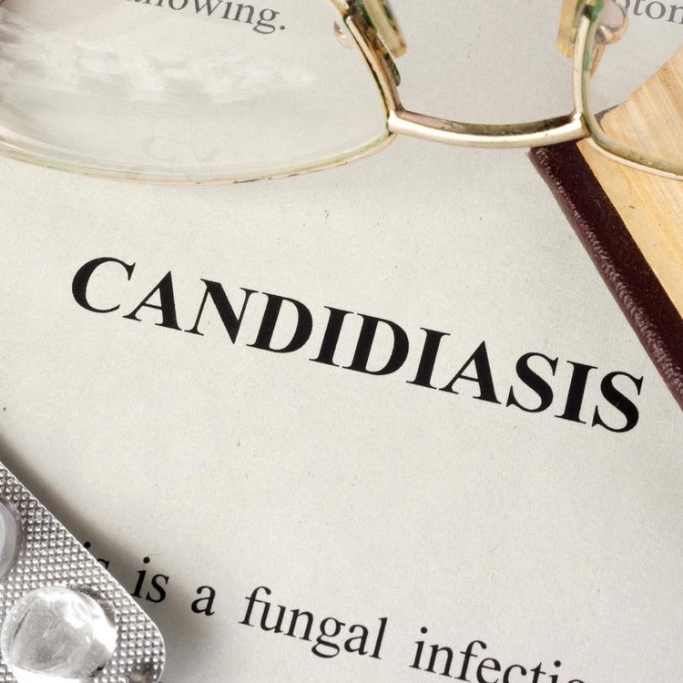 Ilustrasi Kandidiasis Ilustrasi Kandidiasis