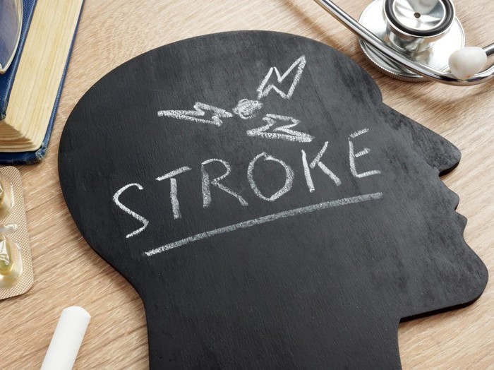 Ilustrasi stroke
