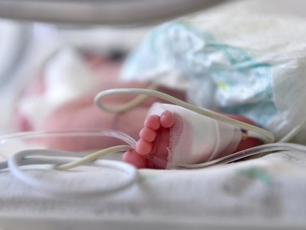 Kisah Pilu Bayi Terlahir dengan 2 Wajah, 4 Kaki, dan 4 Tangan di India