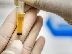 Oknum Perwira Polisi di Polman Sulbar Positif Narkoba Saat Dites Urine