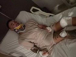 Brian Hunt, Bule Australia yang Heboh Dirampok Ternyata Kecelakaan