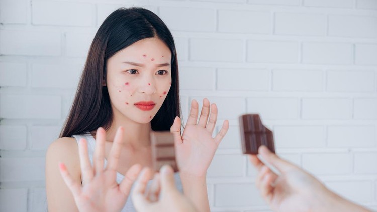 1136308195 Young Asian woman acne problem face with chocolate bar refuses unhappy eating.