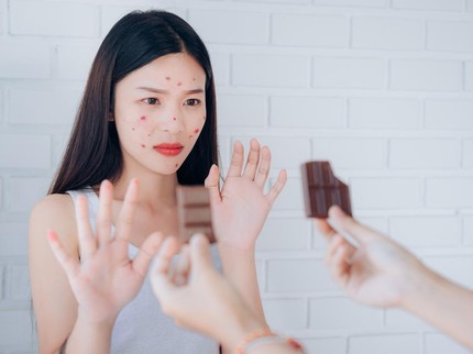 7 Pantangan Makanan untuk Wajah Berjerawat Agar Tidak Makin Parah