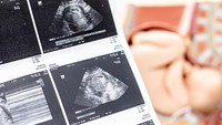 Bisakah Memprediksi Jenis Kelamin Bayi dari Denyut Jantung? Ini Faktanya