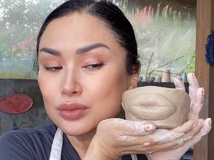 5 Potret Titi DJ Before After Operasi Anti Aging di Gangnam Korea Selatan