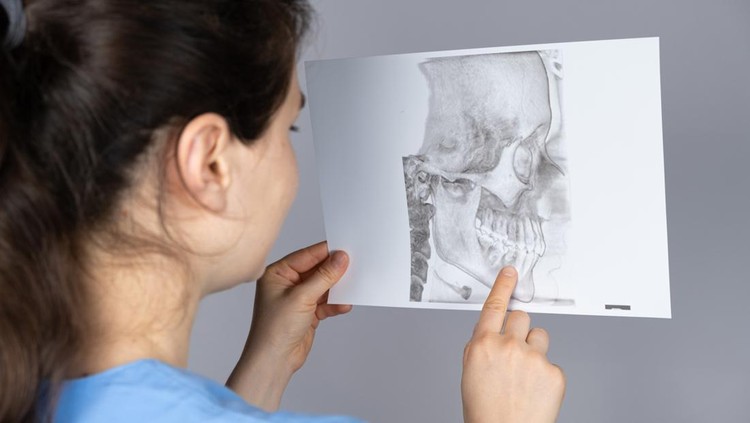 1437976211 The doctor holds a CT scan of a patient with temporomandibular joint dysfunction and malocclusion