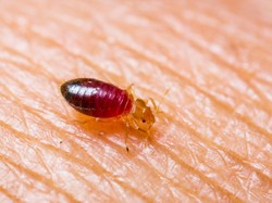 Bikin Gatal dan Meresahkan! Ini Alasan Kutu Busuk Bisa Ada di Sofa dan Kasur