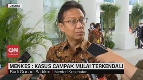 VIDEO: Menkes: Kasus Campak Mulai Terkendali