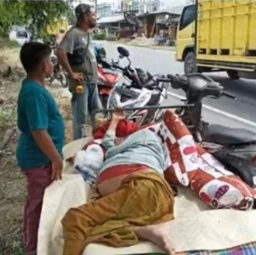 Antar Ayah Berobat, Bocah Asal Aceh Tempuh Jarak 160 Km Pakai Bentor