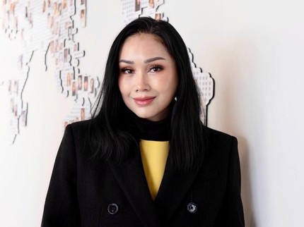 4 Artis Indonesia Mengaku Lakukan Operasi Wajah, Terbaru Titi DJ