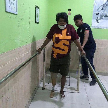 Pasang Kaki Palsu Usai Diamputasi, Suti Karno Ucap Syukur