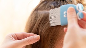 7 Cara Menghilangkan Kutu Rambut beserta Telurnya