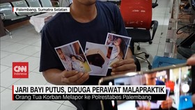 VIDEO: Jari Bayi Putus, Diduga Perawat Malapraktik