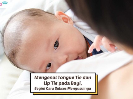 Mengenal Tongue Tie dan Lip Tie pada Bayi, Begini Cara Sukses Menyusuinya