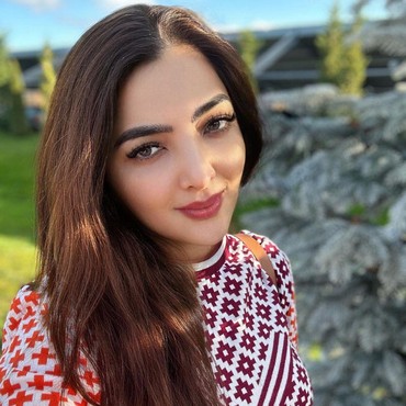 Autoimun Kembali Kambuh, Ashanty Sebut juga Ada Polip