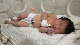 FOTO: Mukjizat Bayi Baru Lahir Selamat Tertimbun Puing Gempa Suriah