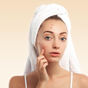 BeauPicks: Bye-bye Jerawat! Yuk Coba 5 Acne Spot Treatment Ini yang Ampuh untuk Menghilangkan Jerawat Hingga Bekasnya
