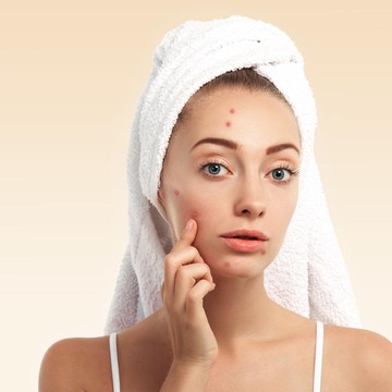 img-title BeauPicks: Bye-bye Jerawat! Yuk Coba 5 Acne Spot Treatment Ini yang Ampuh untuk Menghilangkan Jerawat Hingga Bekasnya