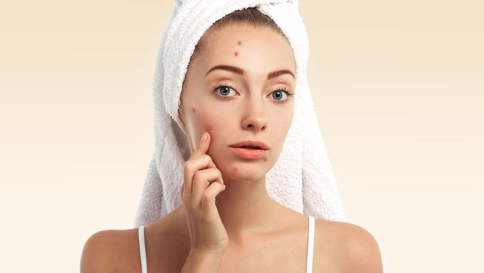 BeauPicks: Bye-bye Jerawat! Yuk Coba 5 Acne Spot Treatment Ini yang Ampuh untuk Menghilangkan Jerawat Hingga Bekasnya BeauPicks: Bye-bye Jerawat! Yuk Coba 5 Acne Spot Treatment Ini yang Ampuh untuk Menghilangkan Jerawat Hingga Bekasnya