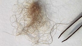 Ahli Bongkar Hasil Tes DNA Rambut 'Yeti' di Himalaya