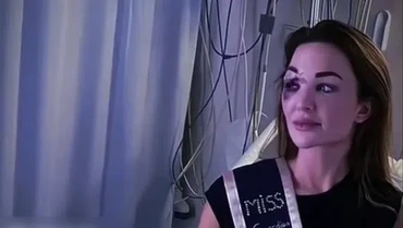 Kecelakaan Tragis Jelang Final, Miss Belgia 2022 Pamer Wajah Penuh Luka