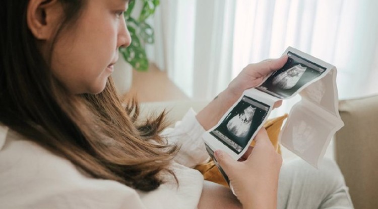 LETAK JANIN DI PERUT TRIMESTER 3 Mungkin banyak dari Bunda hamil di trimester 1, 2, dan 3 yang bertanya-tanya letak janin di perut sebelah mana ya? Yuk ketahui faktanya di sini, Bunda.
