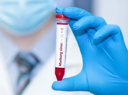 Ini Gejala Virus Marburg yang Mewabah di Afrika