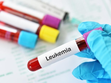 Kisah Penyintas Leukemia Bisa Sembuh Usai Perawatan Dua Tahun, Penuh Haru!
