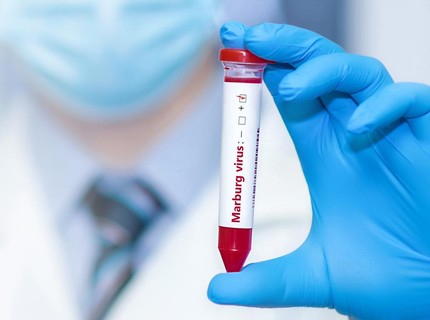 Wabah Virus Marburg Mengintai, Menkes: di Indonesia Belum Ada