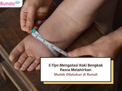 5 Tips Mengatasi Kaki Bengkak Pasca Melahirkan, Mudah Dilakukan di Rumah