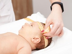 Bayi Terlihat Berkaki Enam Lahir Prematur di RSUD Selong Lombok Timur