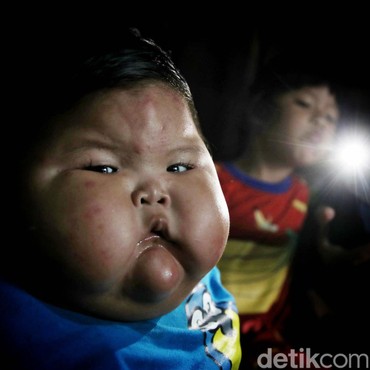 Ibunda Ungkap Porsi Makan Tak Biasa Kenzie Bocah Obesitas